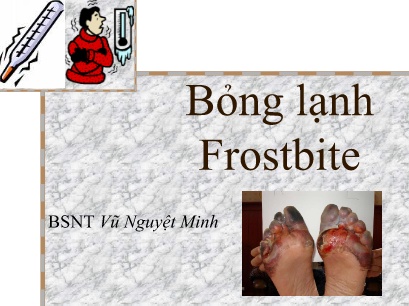 Bài giảng Bỏng lạnh Frostbite