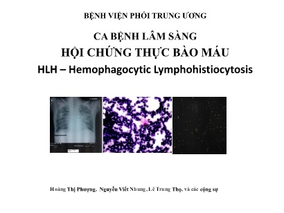 Bài giảng Ca bệnh lâm sàng hội chứng thực bào máu