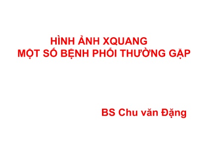 Bài giảng Hình ảnh Xquang một số bệnh phổi thường gặp