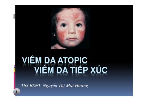 Bài giảng Viêm da Atopic viêm da tiếp xúc